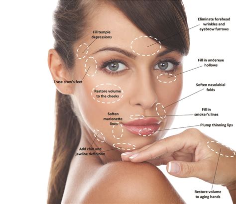 Beginner's Guide to Dermal Fillers. What to Expect? - Medwell Aesthetics