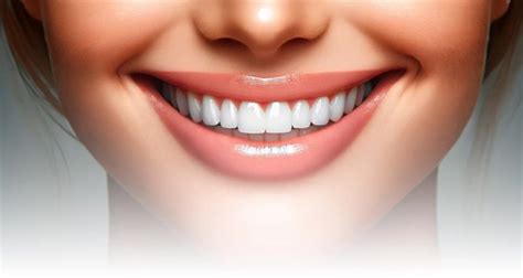 Composite Resin Veneers vs Porcelain Veneers, which is better?