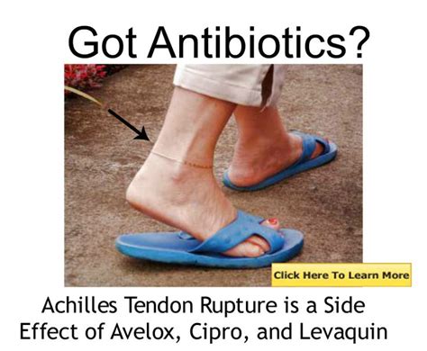 The Quinolone Family of Antibiotics: Avelox, Cipro, and Levaquin can cause tendon rupture ...