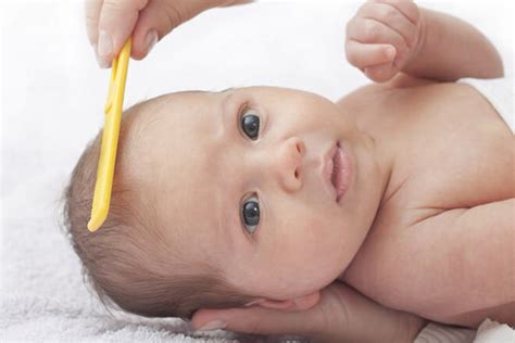 Cradle Cap Treatment: 8 tips to conquer it once and for all