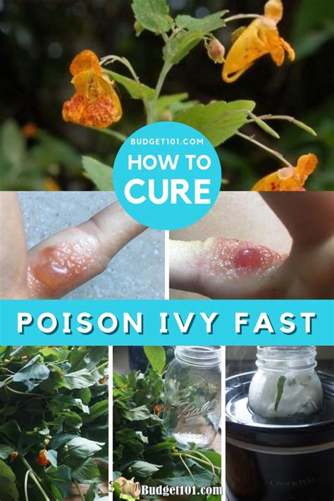 Overnight Poison Ivy Remedy - by Budget101.com™ | Poison ivy remedies ...