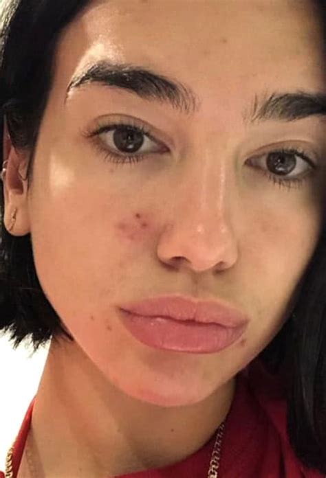 Top 7 Dua Lipa Without Makeup Pictures Revealed