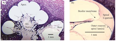 Images from histology slide preparations from specimen EG 9. A: A ...