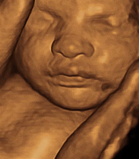 3d 30 Week Ultrasound: What To Expect? - Crying Toddlers