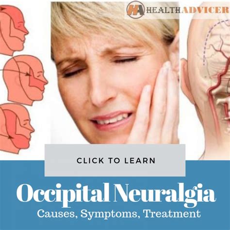 What Is Occipital Neuralgia Occipital Neuralgia Causes Symptoms And | Images and Photos finder