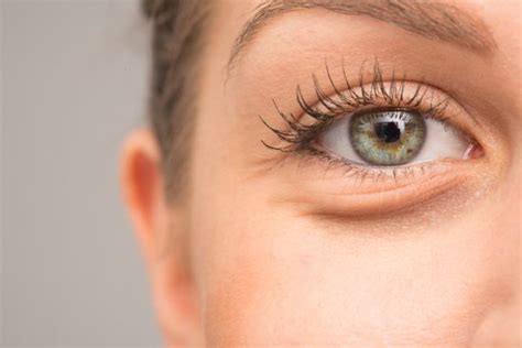 How to Reduce Under-Eye Bags | Harley Street MD