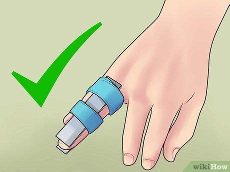 How To Wrap Up A Fractured Finger - Margaret Greene Kapsels