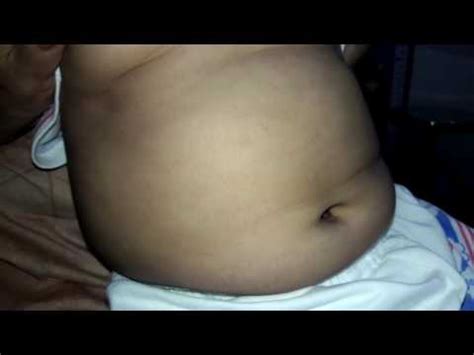 Swollen stomach of small children - YouTube