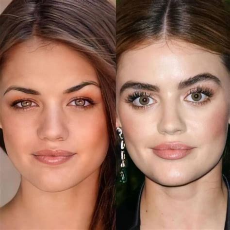 25 celebrities who got lip fillers and changed their looks forever ...