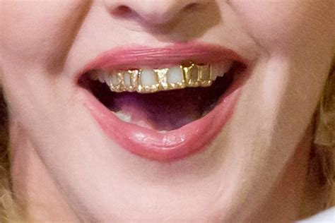 Get A Grillz For Your Teeth at Sherry Garcia blog