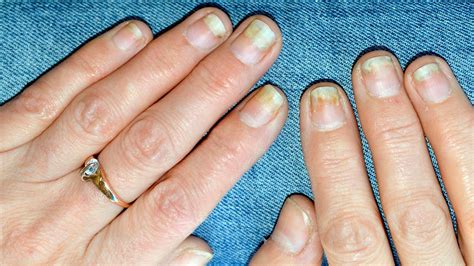 Things Your Nails Can Tell You About Your Health – Femanin