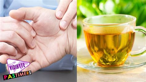 Green Tea helps you fight Arthritis and Joint Pain || Health News - YouTube