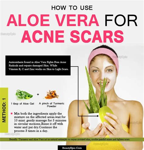 Aloe Vera For Acne Scars – Benefits And How To Use It