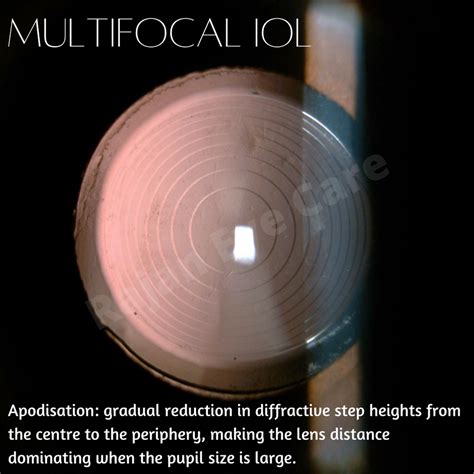 Multifocal IOL - Types!