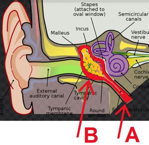 Ear Infections - Medical Care One