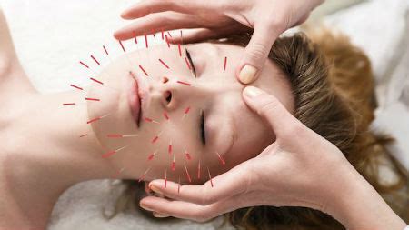 Acupuncture for Depression: Does It Really Work? - Advanced Chiropractic Spine & Sports Medicine