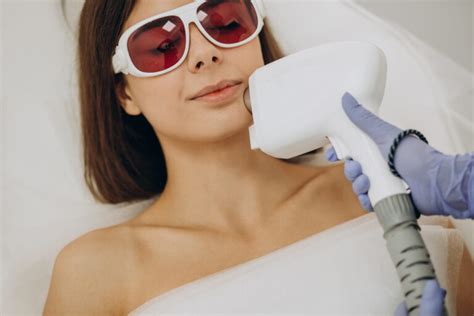 IPL Skin Rejuvenation | SOL Aesthetics