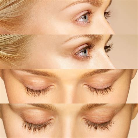 Latisse Eyelash Lengthening Results for Blonde Woman in Her 30's Before ...