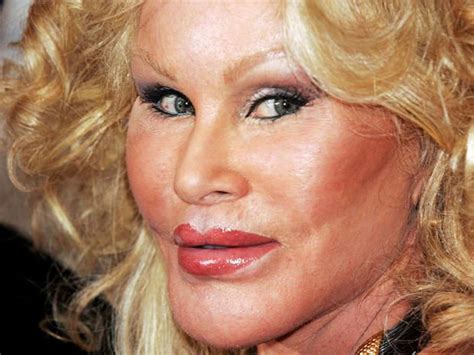 "Jocelyn Wildenstein is a poster child for plastic surgery gone wrong ...