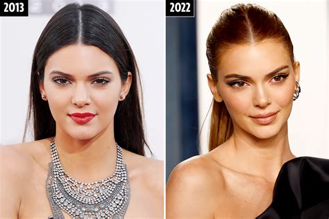 I'm a plastic surgeon - Kendall Jenner may have spent up to $45,000 on secret surgery, here are ...