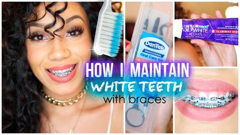 How I Maintain White Teeth with Braces | Dental braces, White teeth ...