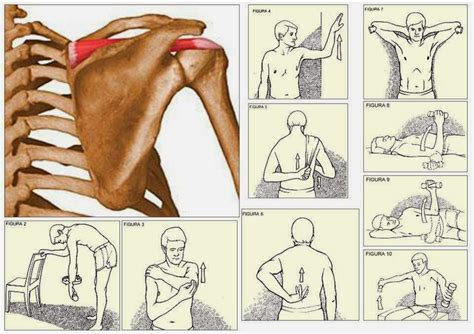 Antiterapia: Problemas no ombro (Supra-espinhoso)? Saiba que exercícios pode fazer