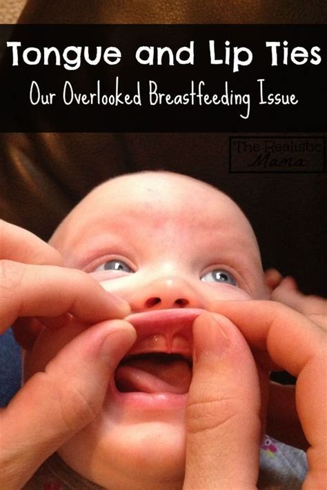 Tongue Tied and Lip Tied Baby - The Realistic Mama | Breastfeeding ...