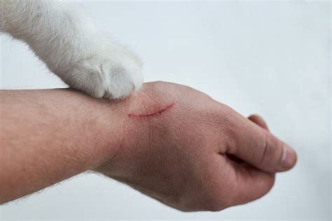 How to Treat a Cat Scratch: 6 Vet-Approved Steps - Catster