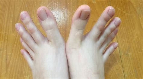 Internet’s going crazy over this girl who has toes as long as fingers | Trending News - The ...