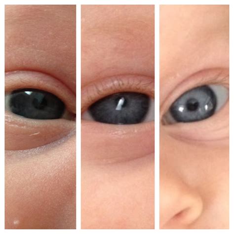 Brown Baby Eye Color Change Progression at Julio Meadows blog