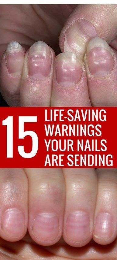 15 Health WARNINGS Your Fingernails Are Sending | Nail health signs, Fingernail health signs ...