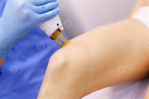 Woman receiving legs laser hair removal at a beauty center. 3713551 ...