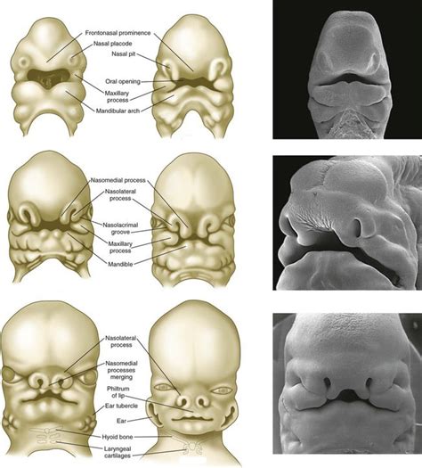 Development of the Face - Nose - Palate - Cleft Lip - TeachMeAnatomy