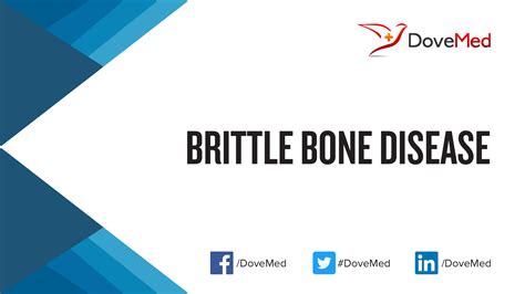 Brittle Bone Disease
