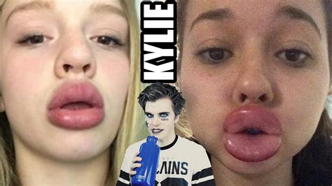 The Kylie Jenner Challenge (Swollen Lips Challenge) | UHOHBRO - YouTube