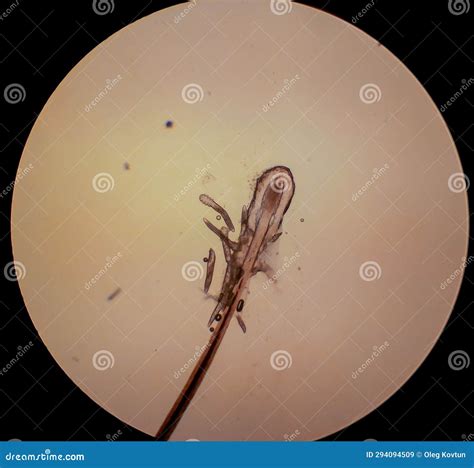 Demodex Folliculorum - Parasitic Mite on the Eyelashes of a Human Eye Stock Image - Image of ...