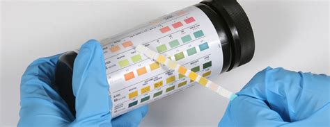 Glucose urine test