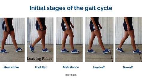 Gait Abnormalities | Geeky Medics