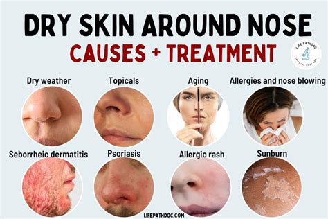 Dry and Peeling Skin Around Nose: 13 Causes & How to Treat it