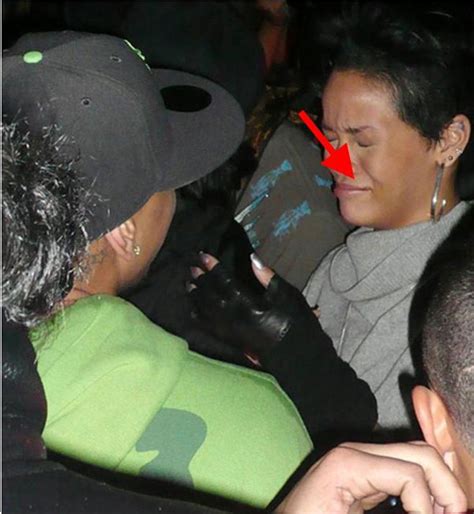 Rihanna Gave Chris Brown Herpes