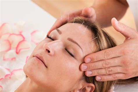 Acupuncture For Migraines: How It Works: Osteopathic Center for Healing: Physical Medicine ...