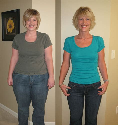 Weight Loss Surgery Options ~ Lose Weight