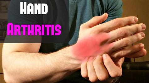 Fast Treatment for Hand Arthritis ~ Self Massage! - YouTube