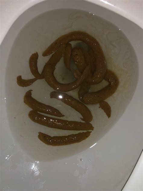 Not my picture but similar how my poop looks from time to time. Is this ...