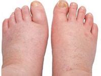 Foot pain symptoms
