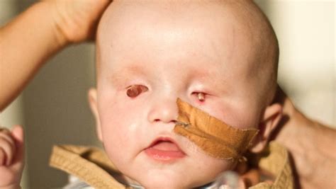 Baby born without eyes: GoFundMe campaign is trending for Archie | news.com.au — Australia’s ...