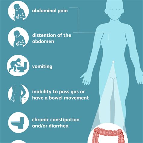 Cecal Volvulus: Symptoms, Causes, Diagnosis, and Treatment