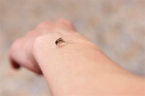 Mosquito bite pop – yes or no? What is important to know?