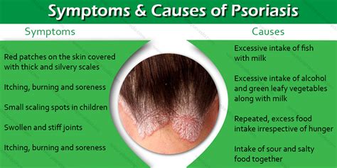 Top 7 Proven Natural Remedies to Treat Psoriasis | ArticleCube
