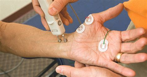 Electromyography (EMG): Purpose, Procedure, and Results